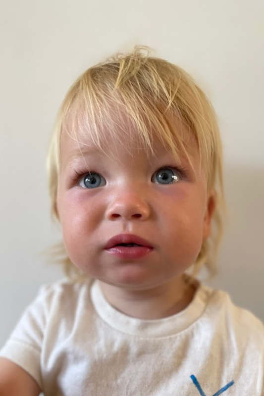 NOA